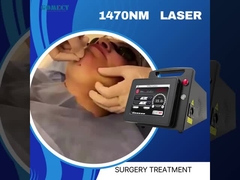 Endolaser 1470 Lifting Facial Lipolysis Endovenous Laser Rimozione della vena a ragno